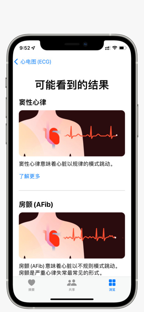 Apple Watch可以提供四个类别的结果 国行Apple Watch ECG功能实测 它让你更好地了解自己