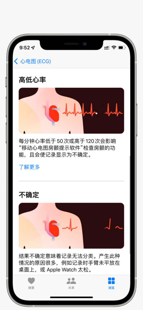 国行Apple Watch ECG功能实测 它让你更好地了解自己
